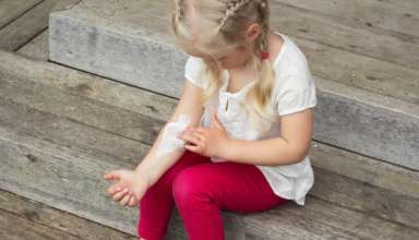 Dermatitis atópica en los niños