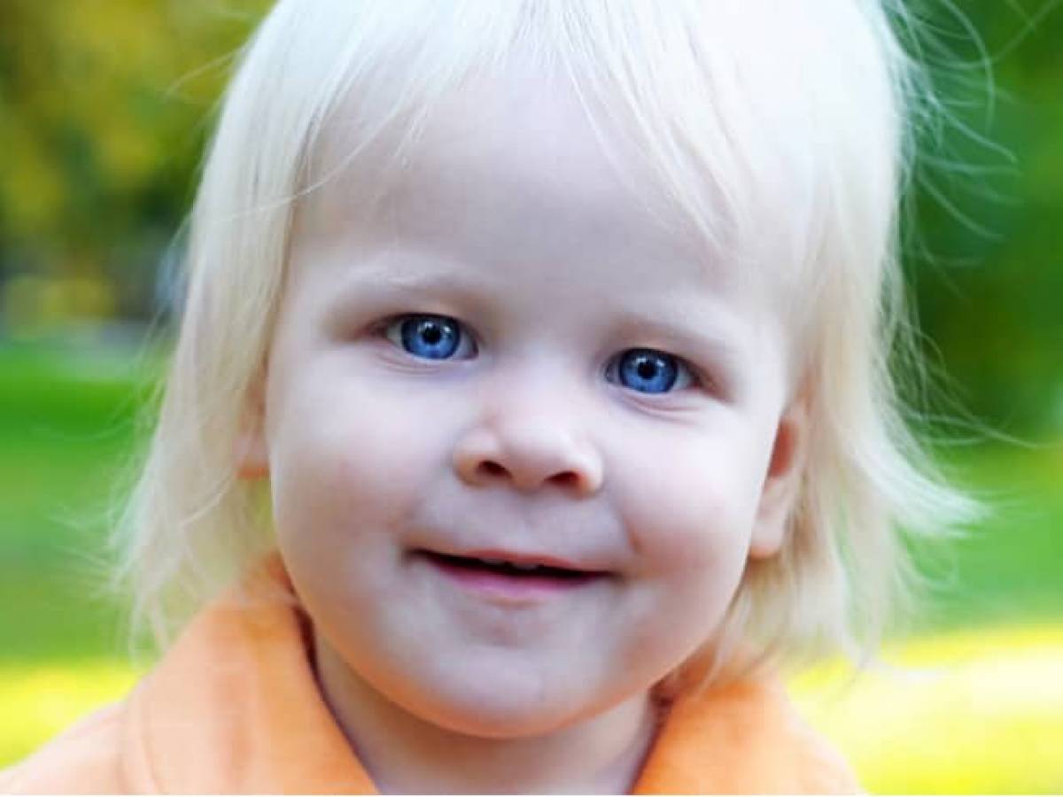 У двух голубоглазых родителей. Дети с белыми волосами. Альбинос. Малыш с белыми волосами. Синдром германски-Пудлака.