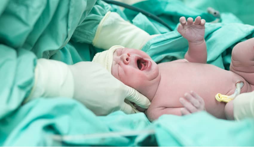 El bebé milagro que nació con un nudo en el cordón umbilical